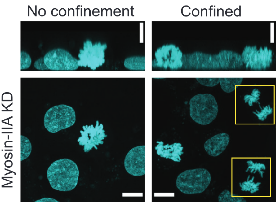 Confinement plus Myosin-II suppression maximizes heritable loss of chromosomes, as revealed by live-cell ChReporters